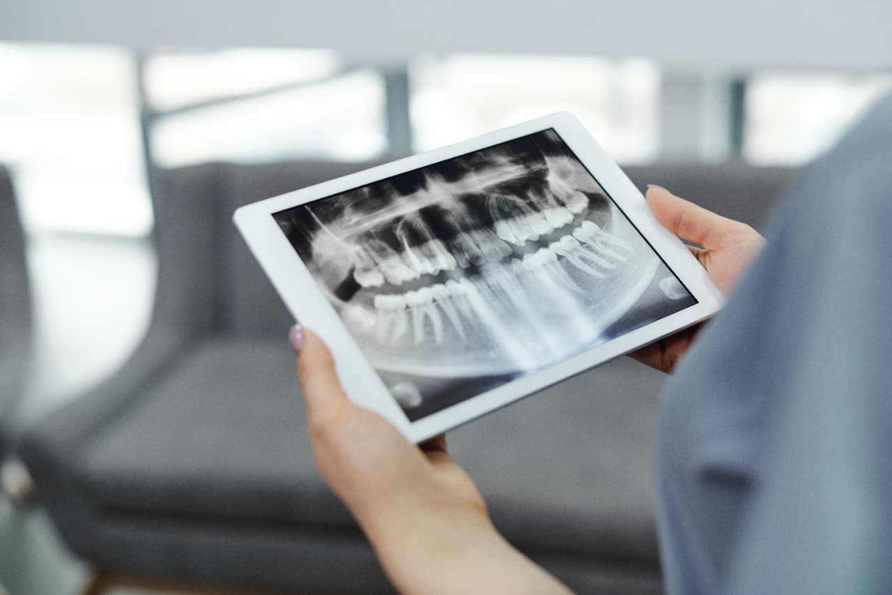 Are Dental X Rays Safe Oral Health Hermiston Dentist Desert Dental